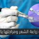 عمليات زراعة الشعر ومراحلها بالتفصيل