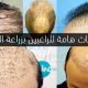 تنبيهات هامة للراغبين بزراعة الشعر