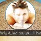 هل يتساقط الشعر بعد عملية زراعة الشعر ؟