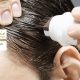 صبغ الشعر بعد عملية زراعة الشعر